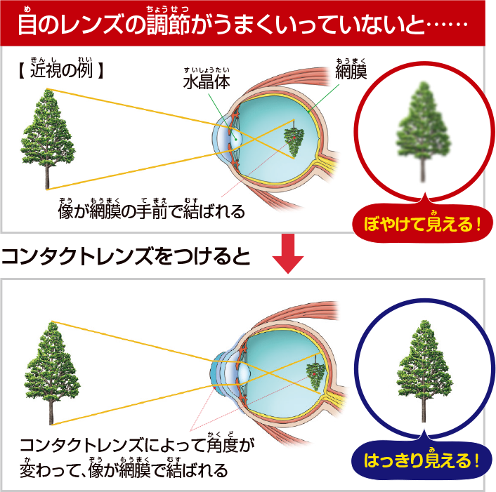 目のレンズの調節