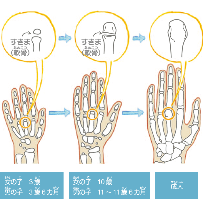 レントゲン写真