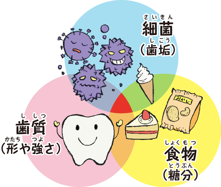 むし歯は三つの要因